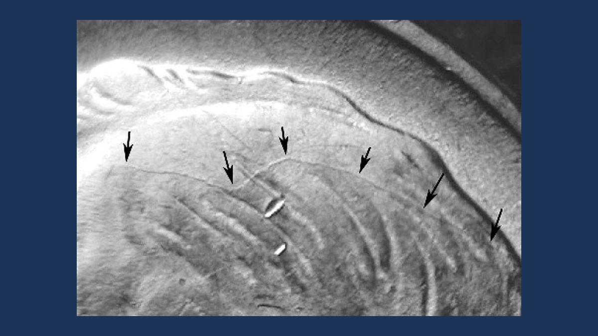 1948 Roosevelt Dime: Die Cracks
